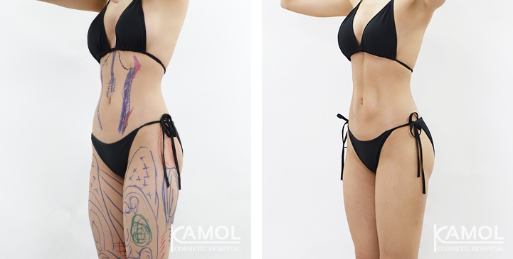 lg-6494959a661a0-image