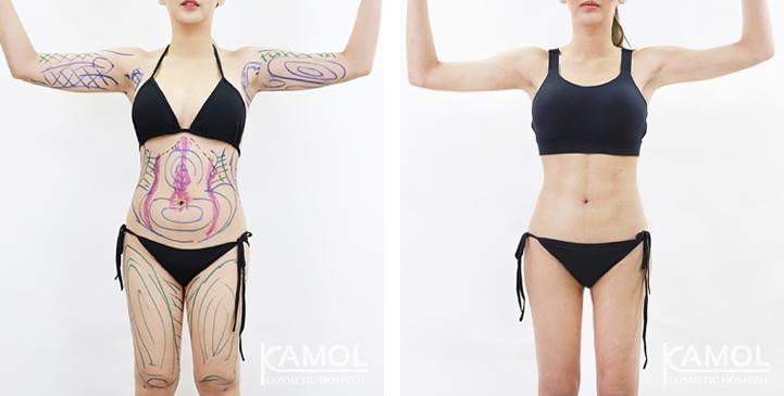 lg-6494959a6bde1-image