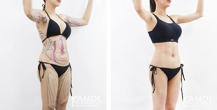 lg-6494959a6dde9-image