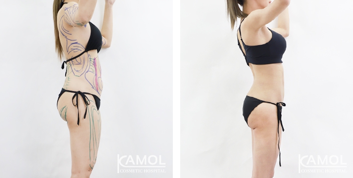 lg-6494959a6fd69-image