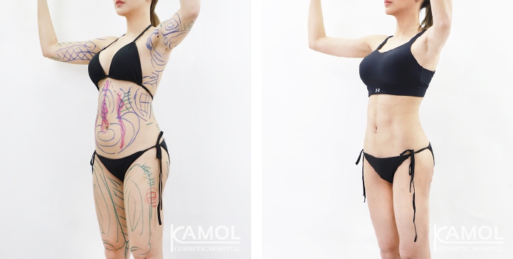 lg-6494959a71c15-image