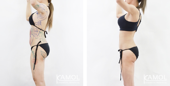 lg-6494959a738d0-image