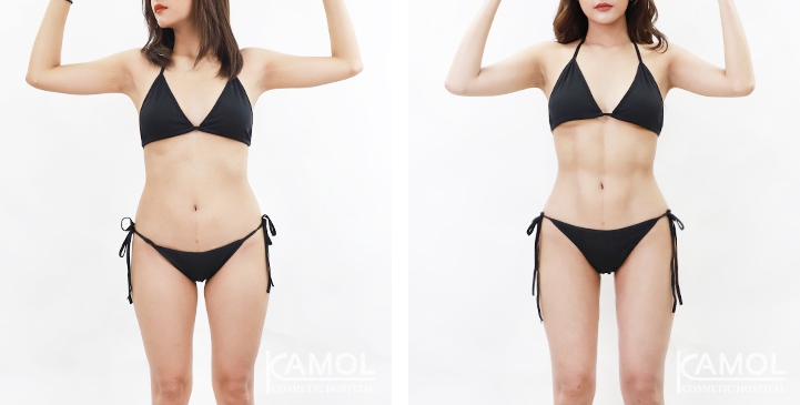 lg-6494959a78f5a-image