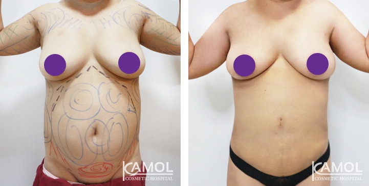 lg-6494959a7eb13-image