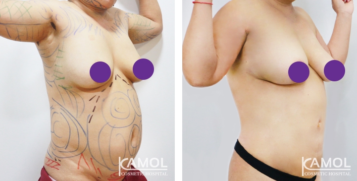 lg-6494959a80cb2-image