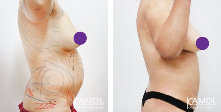 lg-6494959a82f8a-image