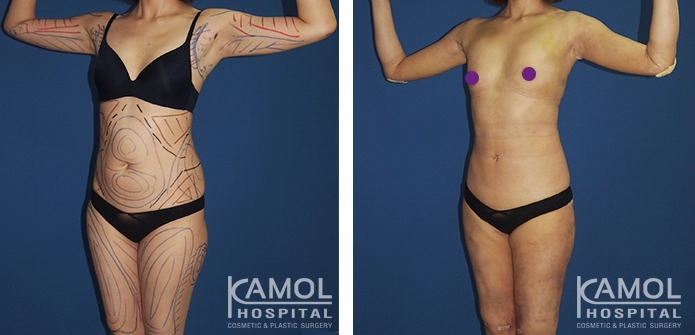 lg-6494959a8c0cf-image