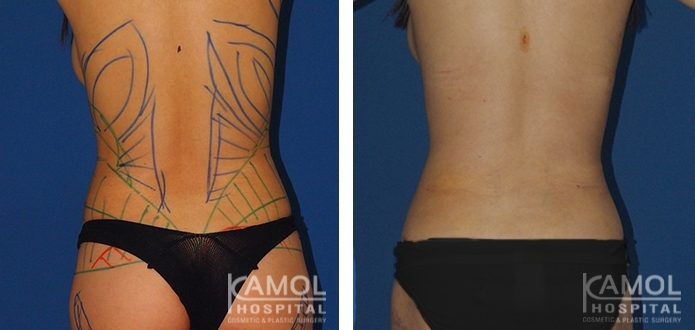 lg-6494959a932ab-image