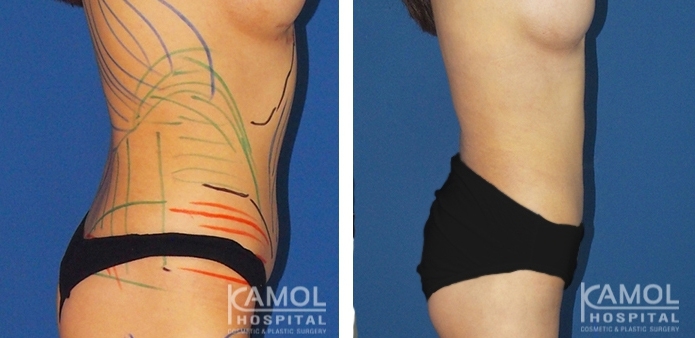 lg-6494959a9525b-image