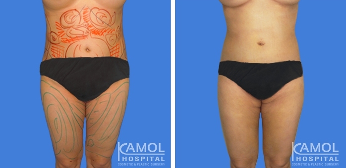 lg-6494959a98119-image