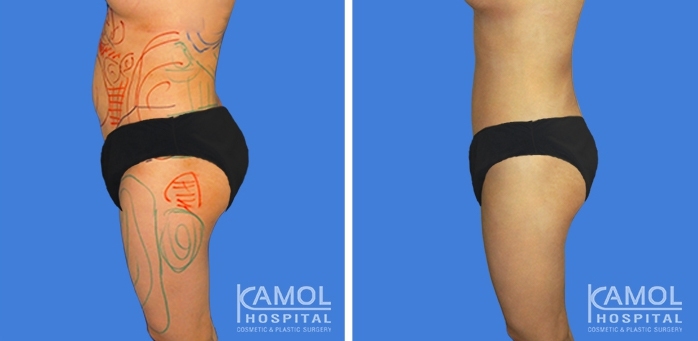 lg-6494959a9a0a6-image