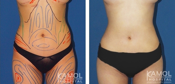 lg-6494959a9d647-image