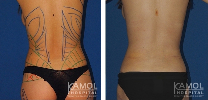 lg-6494959a9f943-image