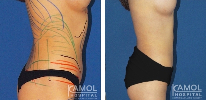 lg-6494959aa1ac2-image