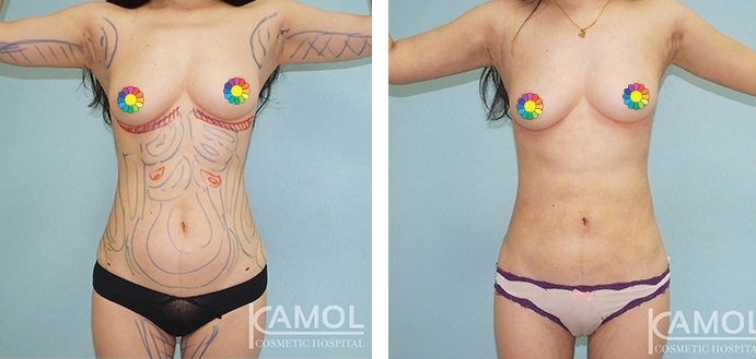 lg-6494959aa511a-image