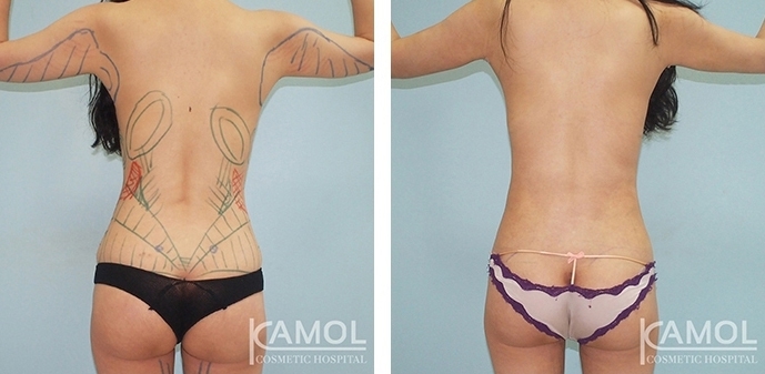 lg-6494959aa71fc-image