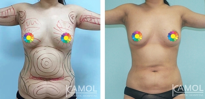 lg-6494959aa9d5c-image