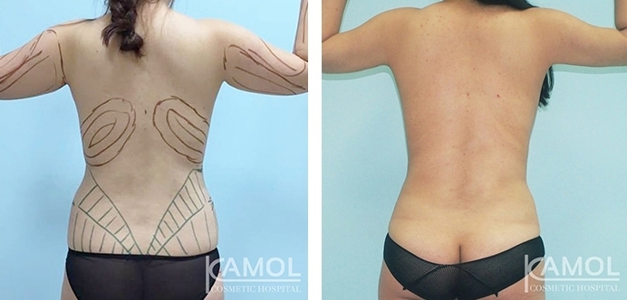 lg-6494959aabce2-image