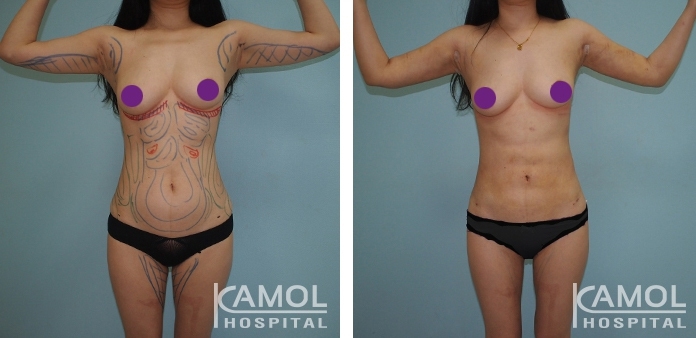 lg-6494959aae789-image