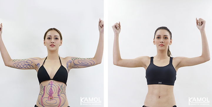 lg-6494959ab518e-image