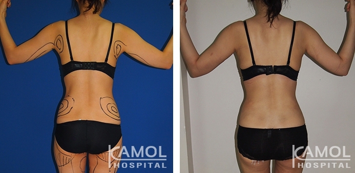 lg-6494959ab7ba0-image