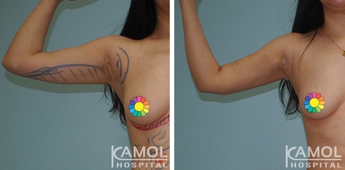 lg-6494959abd8ed-image