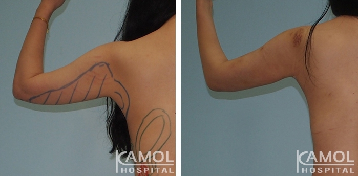 lg-6494959abf598-image