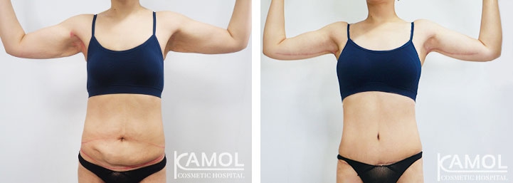 lg-6494959c15ccc-image