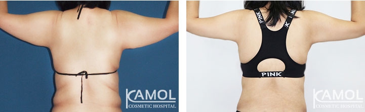 lg-6494959c1a4df-image