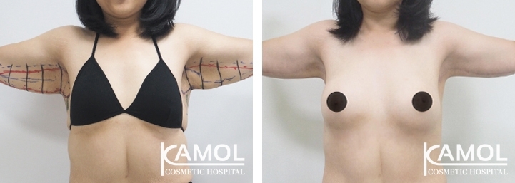 lg-6494959c1cf29-image