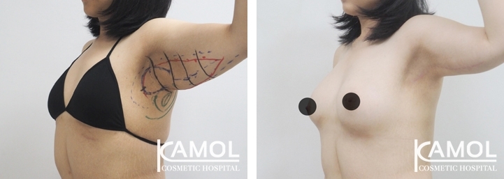 lg-6494959c1efc3-image