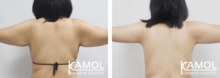 lg-6494959c20e38-image