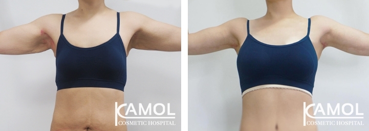 lg-6494959c23b1b-image