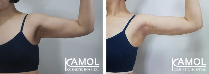 lg-6494959c25ac2-image