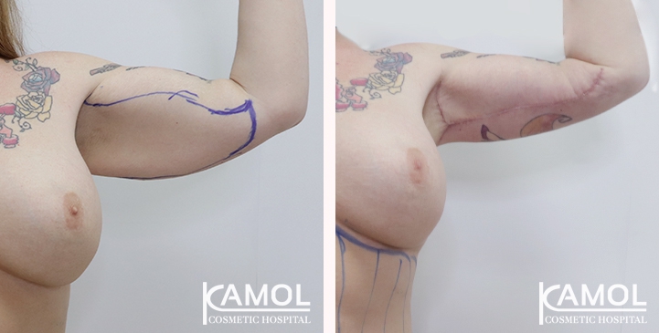 lg-6494959c28718-image