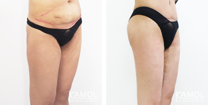 lg-6494959c2e774-image