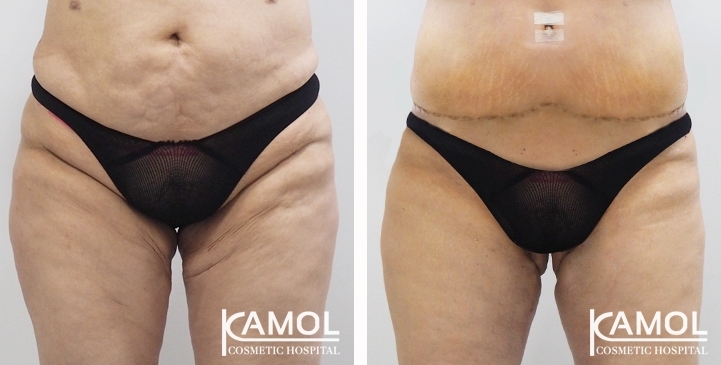 lg-6494959c39189-image