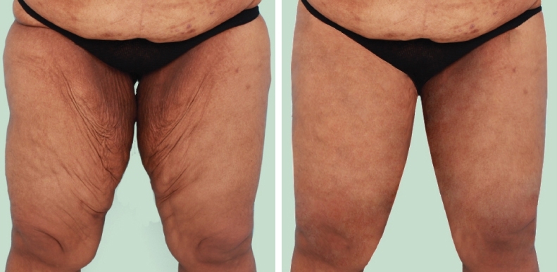 lg-6494959c3c0bb-image