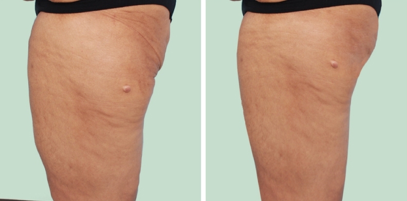 lg-6494959c3e3c1-image