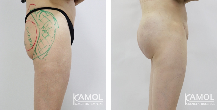 lg-6494959ca3589-image