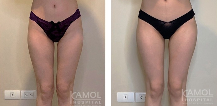 lg-6494959cb4e34-image