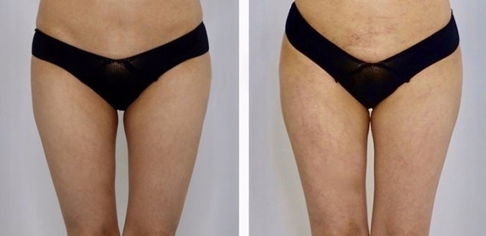 lg-6494959cbb2dd-image