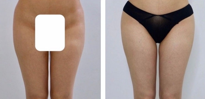 lg-6494959cc855a-image