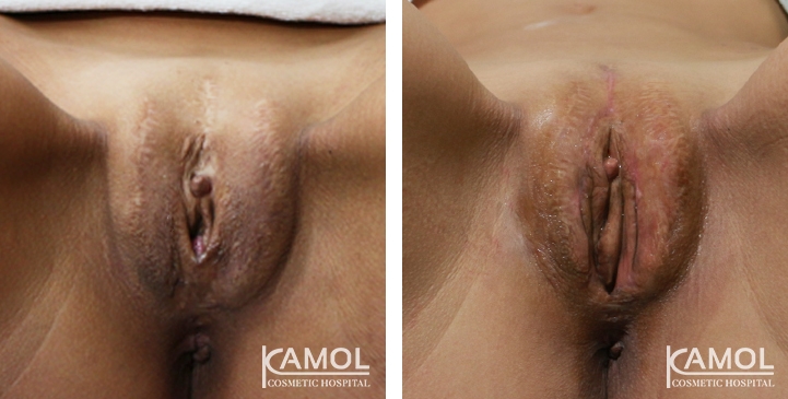 lg-64d1b615392e6-image