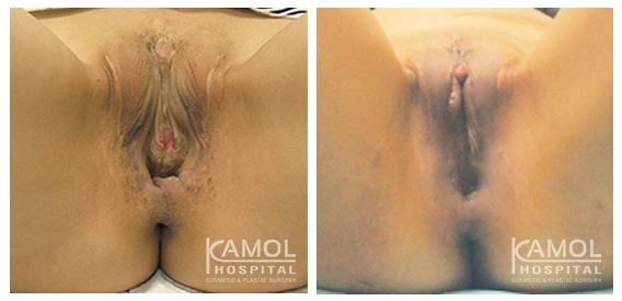 lg-64d756c4d699e-image