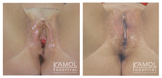 lg-64d756d687913-image