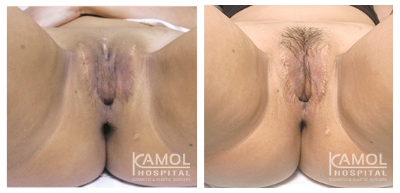 lg-64d756fcef20a-image