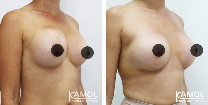 lg-64dc422868d79-image