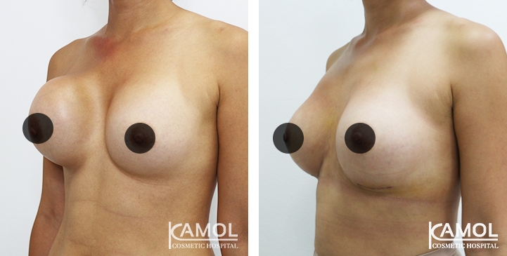 lg-64dc42288bbee-image