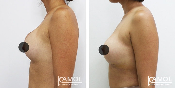 lg-64dc4228a752a-image